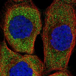 ZNF598 Antibody, Novus Biologicals 25 &mu;L; Unlabeled:Antibodies, Polyclonal